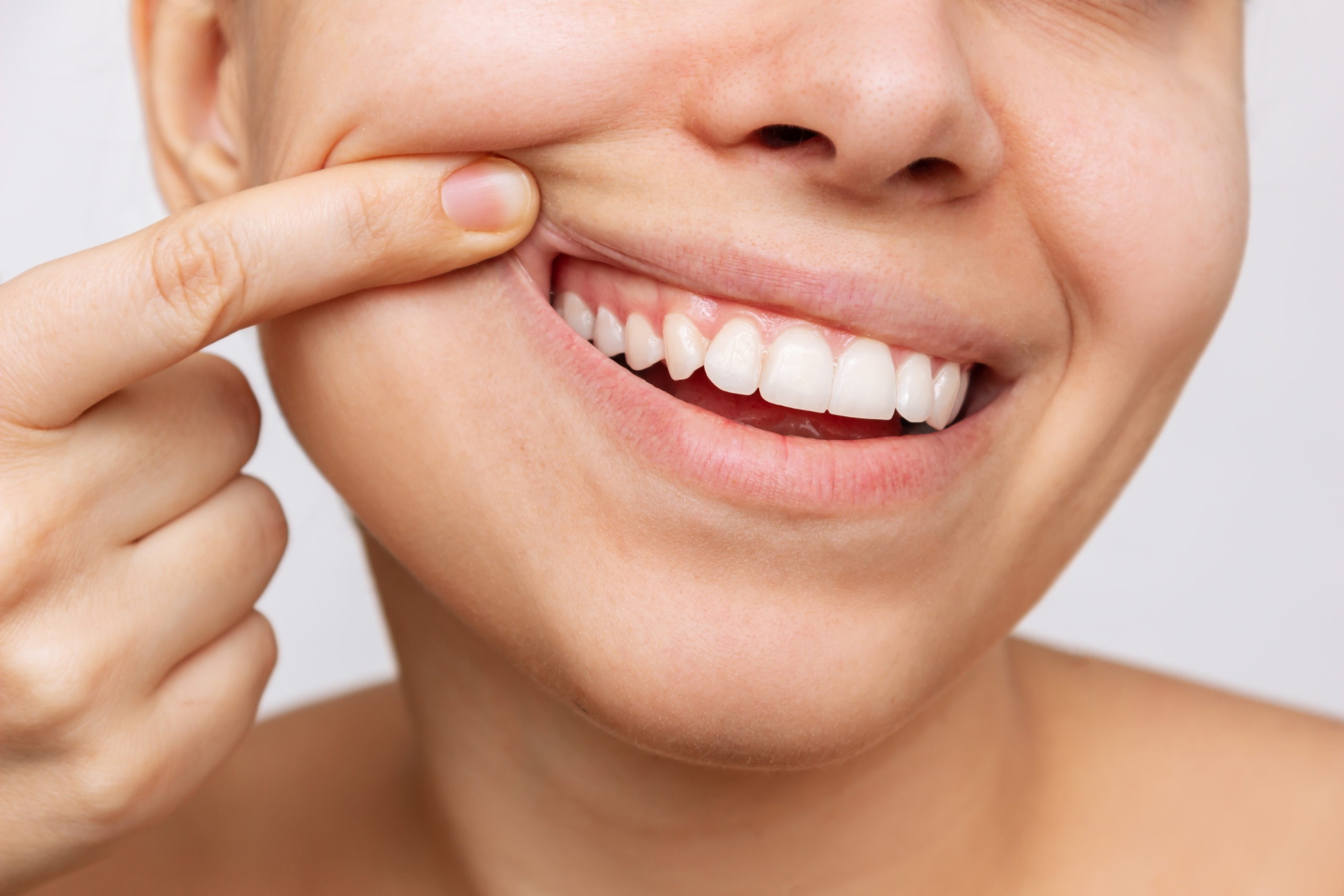 <strong>Harmonisierung des Gingivaverlaufs:</strong> Für das perfekte Zahnfleischlächeln